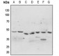 Anti-p47 phox (pS304) Antibody